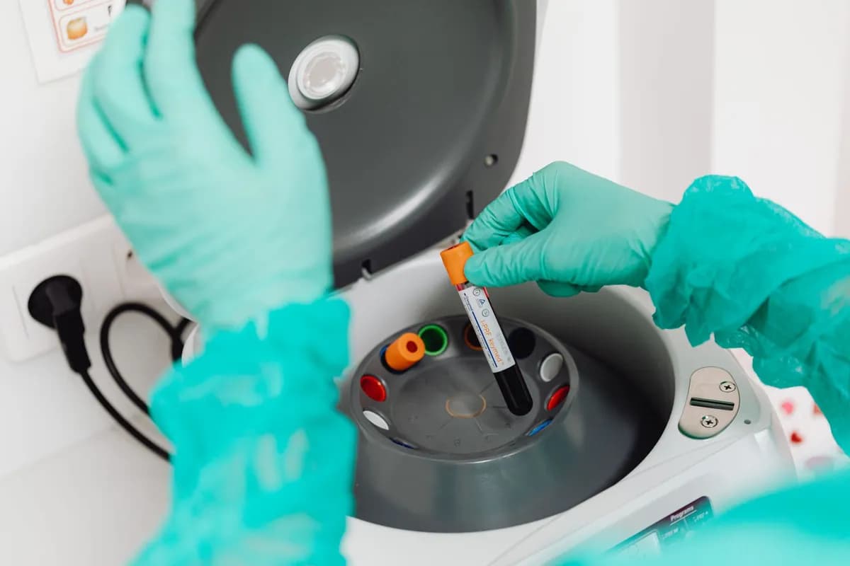 Lab technician analysing a blood sample — blood tests help diagnose hair loss causes in Malta