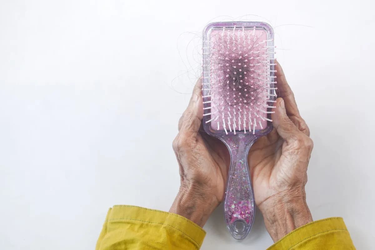 Hairbrush with shed hair strands, illustrating increased shedding during the hair-growth treatment adjustment phase