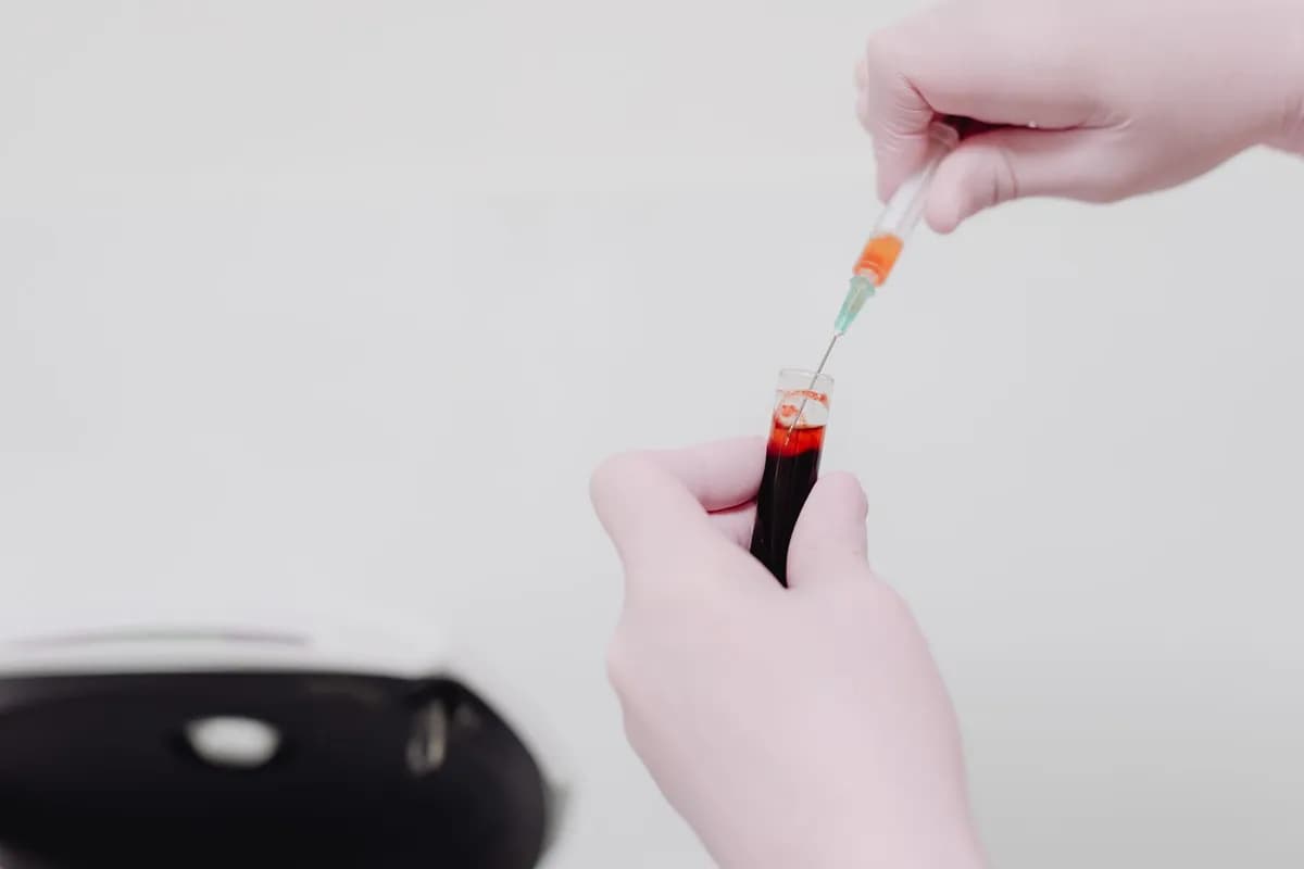 Nurse handling a blood sample vial in a clinical setting — blood tests for hair loss diagnosis Malta
