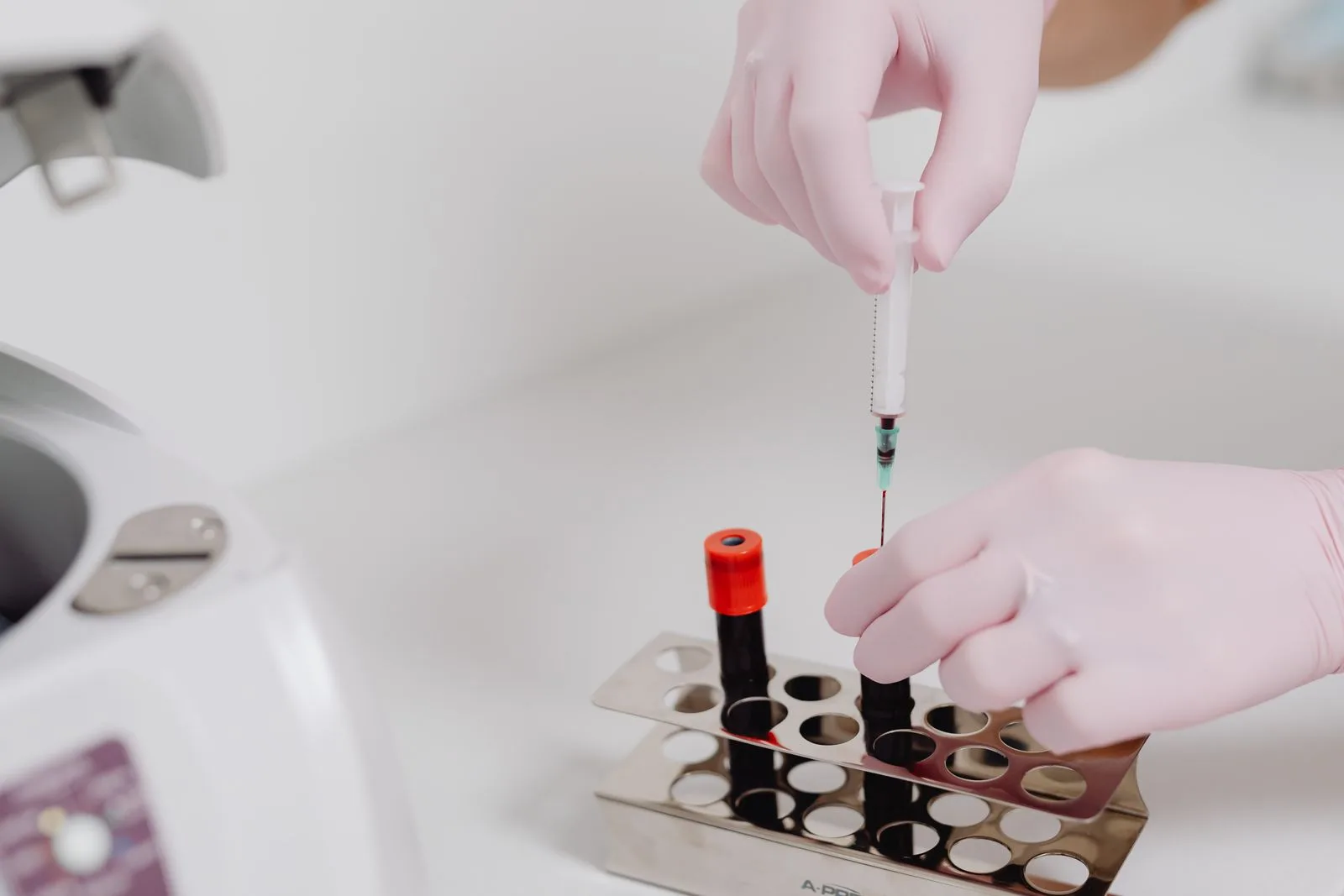Centrifuge and laboratory preparation for platelet-rich plasma hair treatment in Malta